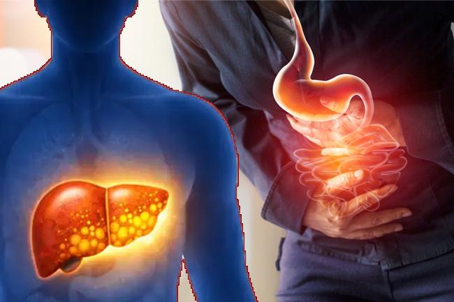 ගැස්ට්රයිටිස් සහ අක්මාවේ තෙල් තැන්පත් වීම නිහඬ මාරයෙක් ද ?