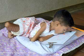 මුවින් ජීවිතයේ කඩයිම ජයගත් පුංචි දියණියක්