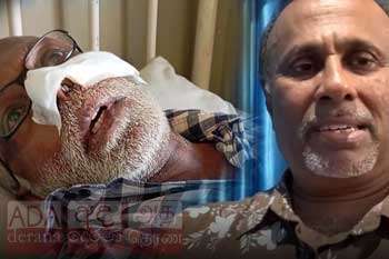 උදයංගගෙන් පහර කෑ අසල්වැසියා රෝහලේ සිට කළ සංවේදි කතාව